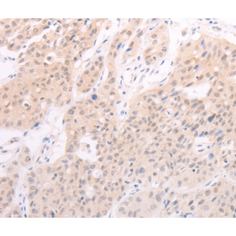 Immunohistochemistry - F7 Antibody from Signalway Antibody (35954) - Antibodies.com
