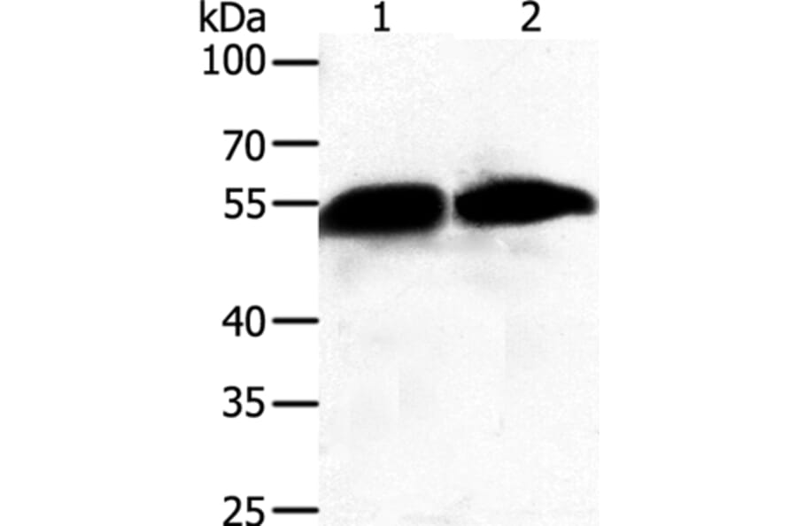 GC Antibody from Signalway Antibody (35989) - Antibodies.com