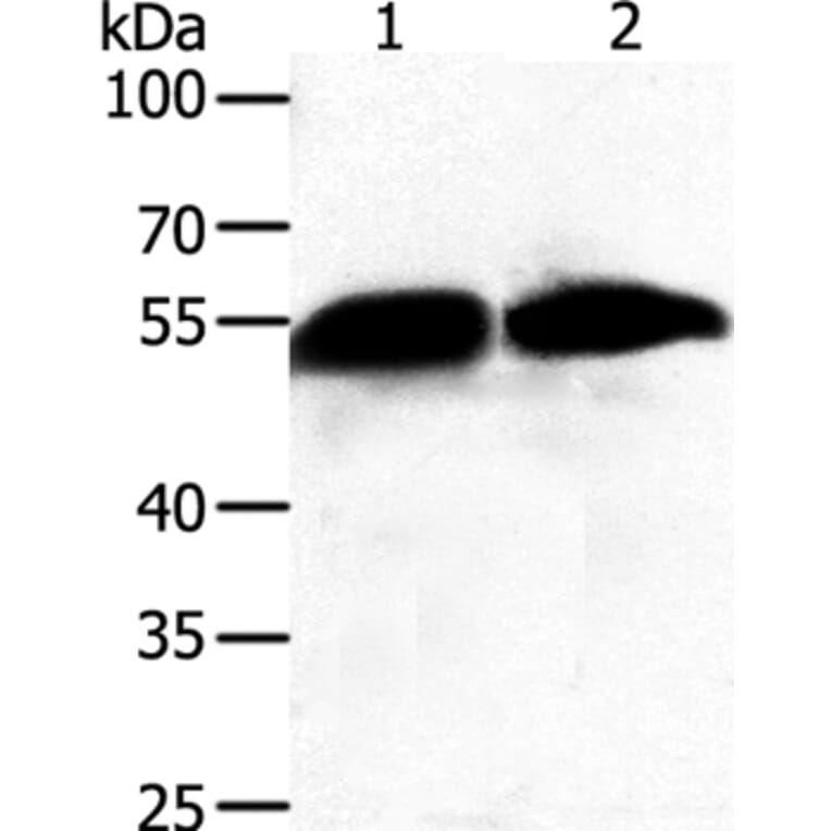 GC Antibody from Signalway Antibody (35989) - Antibodies.com