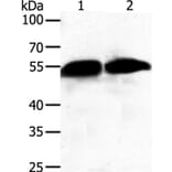 GC Antibody from Signalway Antibody (35989) - Antibodies.com