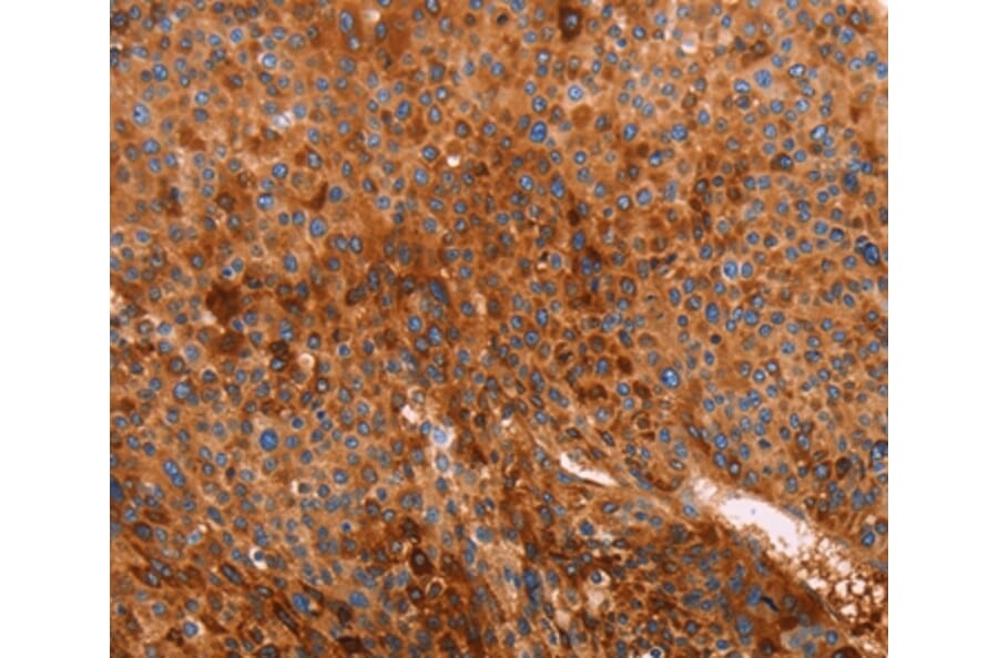 Immunohistochemistry - GC Antibody from Signalway Antibody (35989) - Antibodies.com