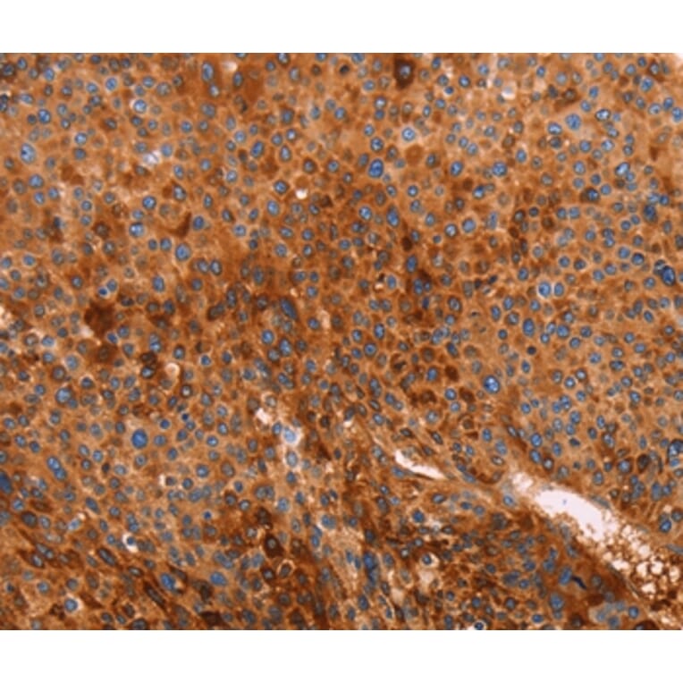 Immunohistochemistry - GC Antibody from Signalway Antibody (35989) - Antibodies.com