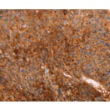 Immunohistochemistry - GC Antibody from Signalway Antibody (35989) - Antibodies.com