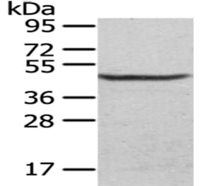 CS Antibody from Signalway Antibody (43035) - Antibodies.com