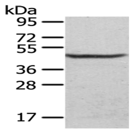 CS Antibody from Signalway Antibody (43035) - Antibodies.com
