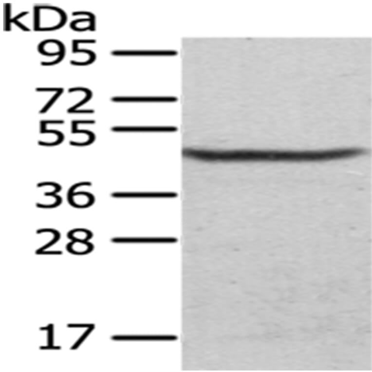 CS Antibody from Signalway Antibody (43035) - Antibodies.com