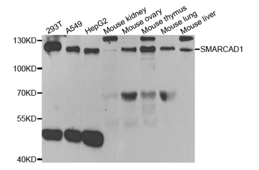 Western blot - SMARCAD1 Antibody from Signalway Antibody (33088) - Antibodies.com