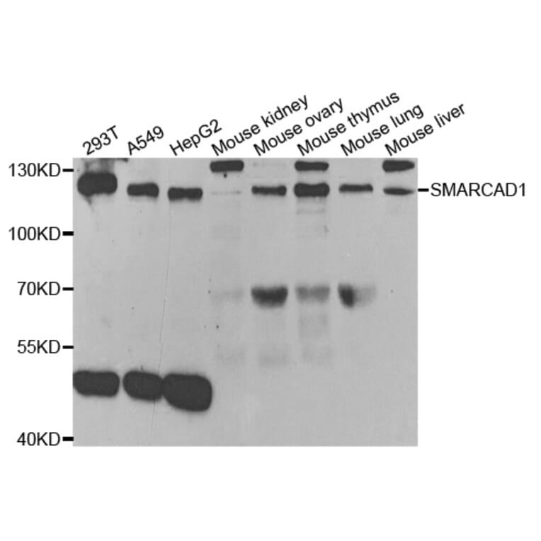 Western blot - SMARCAD1 Antibody from Signalway Antibody (33088) - Antibodies.com