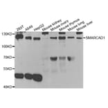 Western blot - SMARCAD1 Antibody from Signalway Antibody (33088) - Antibodies.com