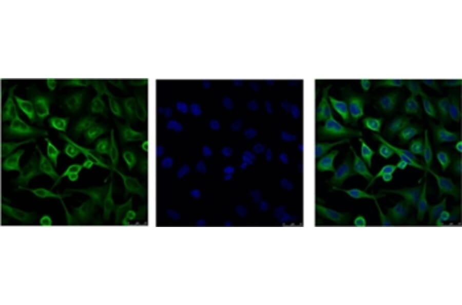 α-tubulin Mouse Monoclonal Antibody from Signalway Antibody (37981) - Antibodies.com