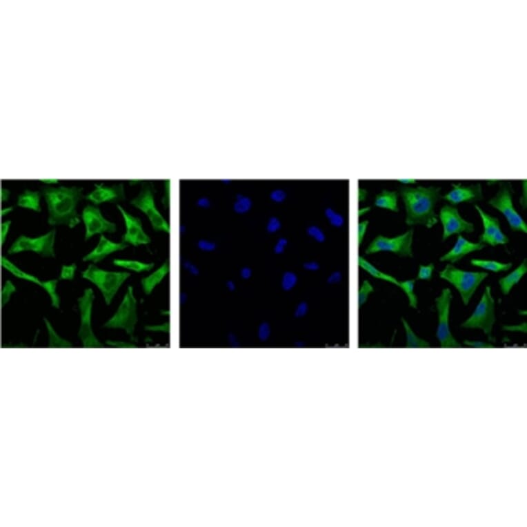 NFκB p65 Mouse Monoclonal Antibody from Signalway Antibody (38054) - Antibodies.com