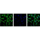 NFκB p65 Mouse Monoclonal Antibody from Signalway Antibody (38054) - Antibodies.com