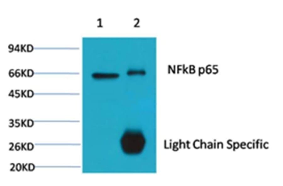 NFκB p65 Mouse Monoclonal Antibody from Signalway Antibody (38054) - Antibodies.com