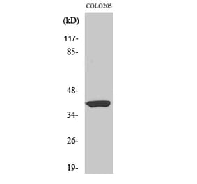 Western blot - Aldolase A Polyclonal Antibody from Signalway Antibody (40581) - Antibodies.com