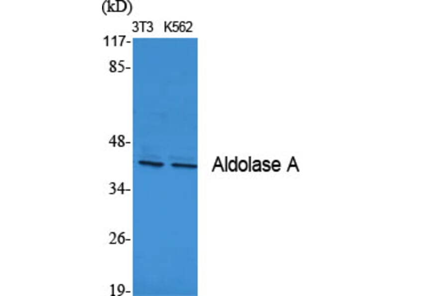 Western blot - Aldolase A Polyclonal Antibody from Signalway Antibody (40581) - Antibodies.com