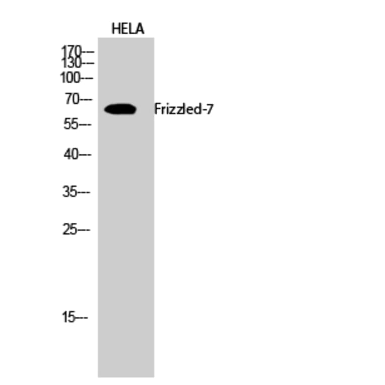Western blot - Frizzled-7 Polyclonal Antibody from Signalway Antibody (40939) - Antibodies.com
