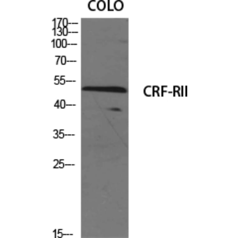 Western blot - CRF-RII Polyclonal Antibody from Signalway Antibody (40786) - Antibodies.com