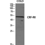 Western blot - CRF-RII Polyclonal Antibody from Signalway Antibody (40786) - Antibodies.com