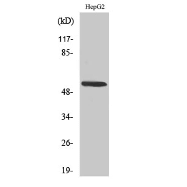 Western blot - CYP26A1 Polyclonal Antibody from Signalway Antibody (40810) - Antibodies.com