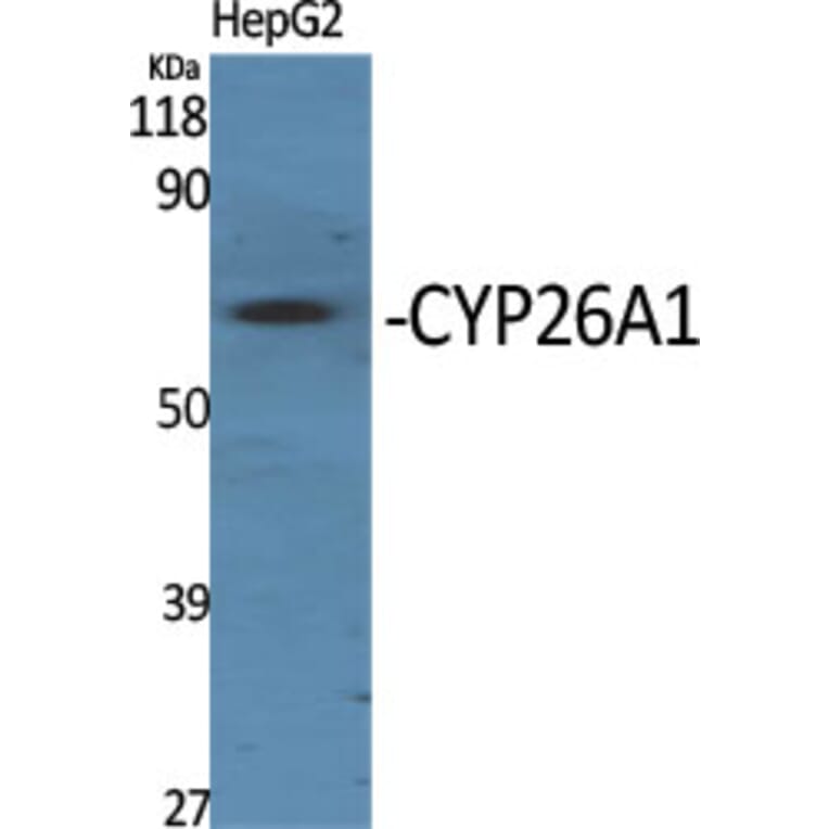 Western blot - CYP26A1 Polyclonal Antibody from Signalway Antibody (40810) - Antibodies.com