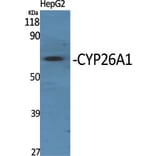 Western blot - CYP26A1 Polyclonal Antibody from Signalway Antibody (40810) - Antibodies.com