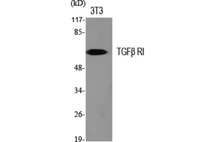Western blot - TGFβ RI Polyclonal Antibody from Signalway Antibody (41491) - Antibodies.com