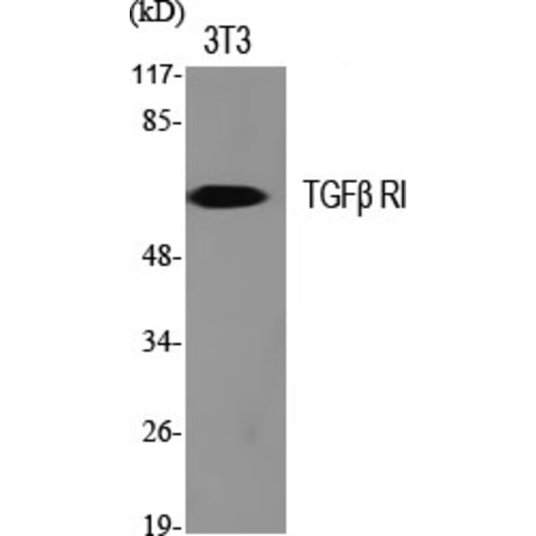 Western blot - TGFβ RI Polyclonal Antibody from Signalway Antibody (41491) - Antibodies.com