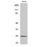 Western blot - CD137L Polyclonal Antibody from Signalway Antibody (40695) - Antibodies.com