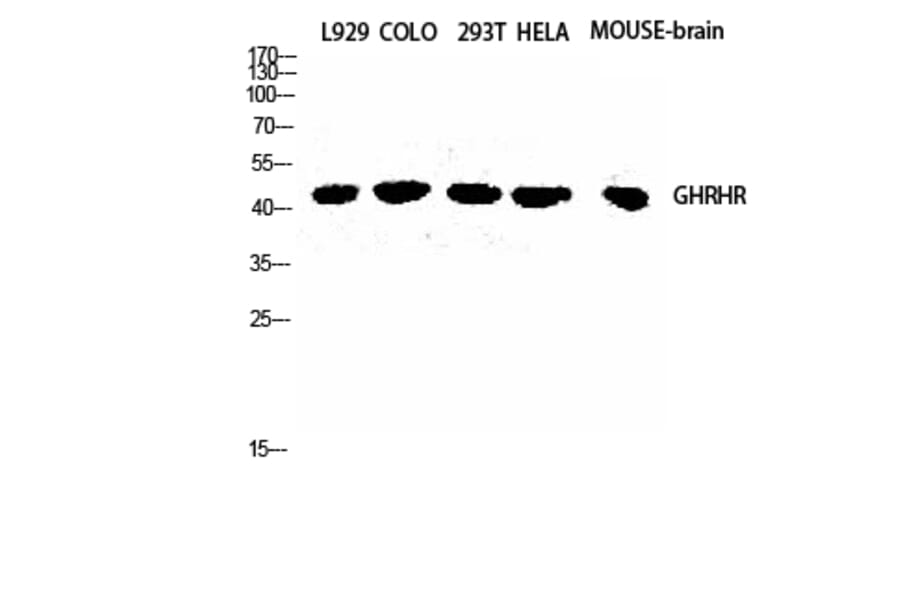 Western blot - GHRH-R Polyclonal Antibody from Signalway Antibody (40962) - Antibodies.com