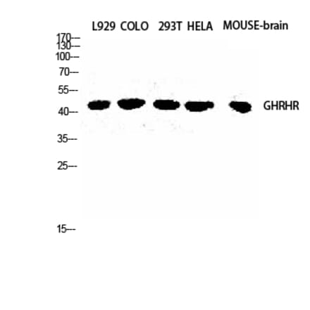 Western blot - GHRH-R Polyclonal Antibody from Signalway Antibody (40962) - Antibodies.com