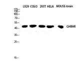Western blot - GHRH-R Polyclonal Antibody from Signalway Antibody (40962) - Antibodies.com