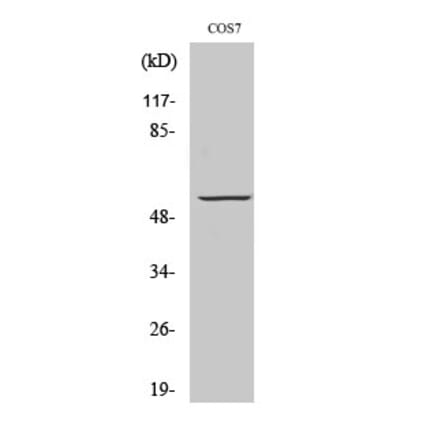 Western blot - GPR101 Polyclonal Antibody from Signalway Antibody (40970) - Antibodies.com
