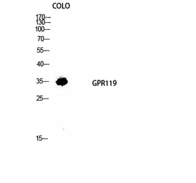 Western blot - GPR119 Polyclonal Antibody from Signalway Antibody (40973) - Antibodies.com