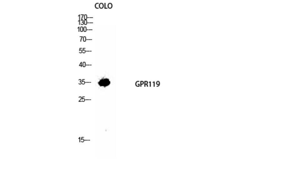 Western blot - GPR119 Polyclonal Antibody from Signalway Antibody (40973) - Antibodies.com
