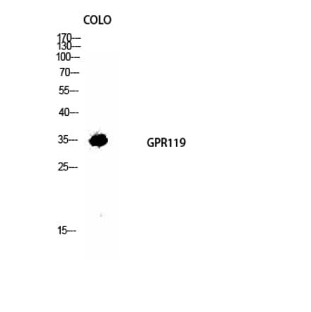Western blot - GPR119 Polyclonal Antibody from Signalway Antibody (40973) - Antibodies.com