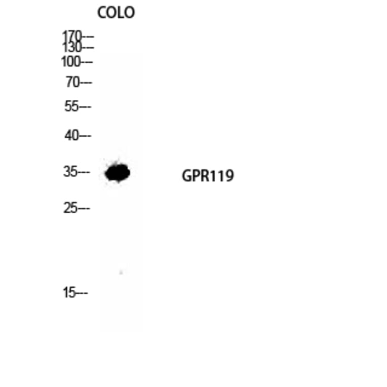 Western blot - GPR119 Polyclonal Antibody from Signalway Antibody (40973) - Antibodies.com