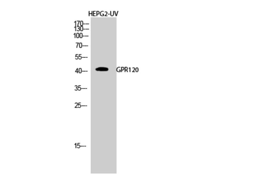 Western blot - GPR120 Polyclonal Antibody from Signalway Antibody (40974) - Antibodies.com