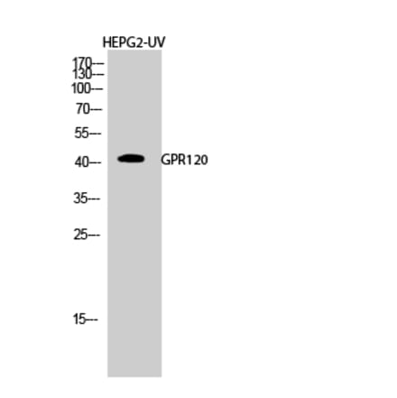 Western blot - GPR120 Polyclonal Antibody from Signalway Antibody (40974) - Antibodies.com