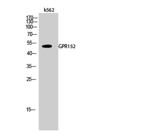 Western blot - GPR152 Polyclonal Antibody from Signalway Antibody (40976) - Antibodies.com