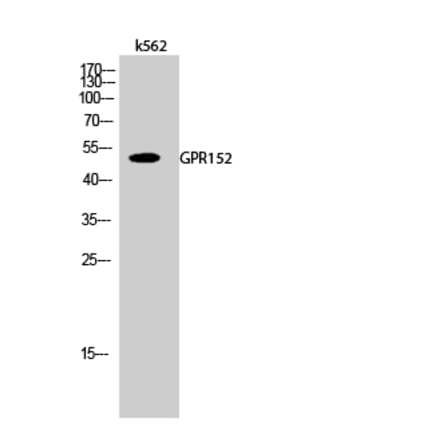 Western blot - GPR152 Polyclonal Antibody from Signalway Antibody (40976) - Antibodies.com