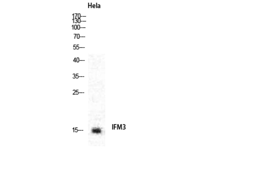 Western blot - IFITM3 Polyclonal Antibody from Signalway Antibody (41051) - Antibodies.com