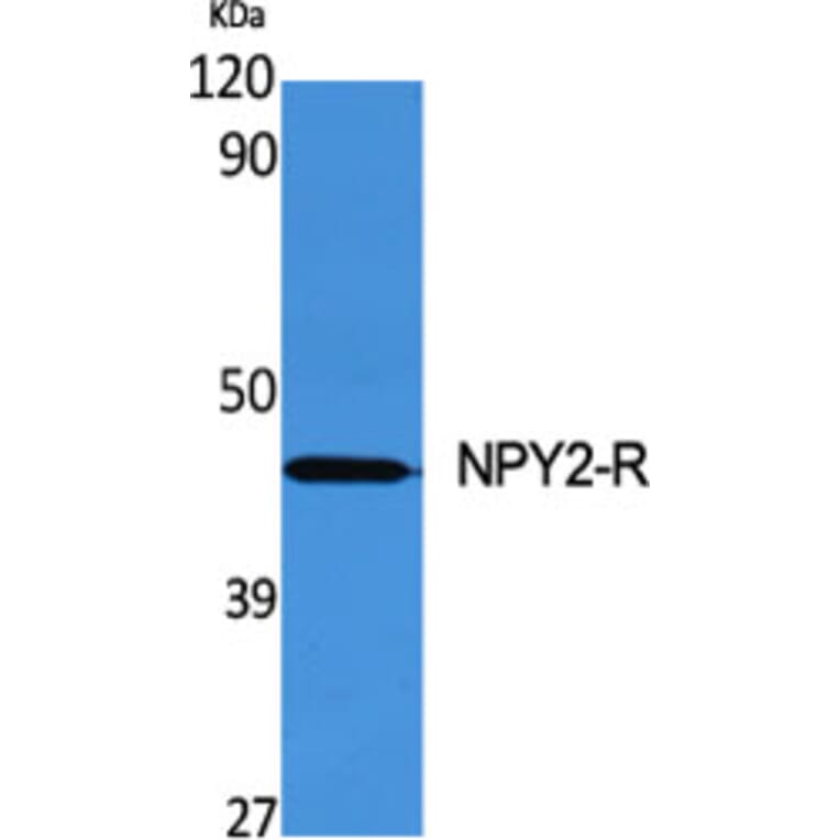 Western blot - NPY2-R Polyclonal Antibody from Signalway Antibody (41253) - Antibodies.com