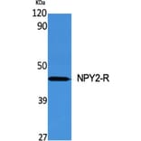 Western blot - NPY2-R Polyclonal Antibody from Signalway Antibody (41253) - Antibodies.com