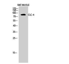 Western blot - CLC-4 Polyclonal Antibody from Signalway Antibody (40755) - Antibodies.com