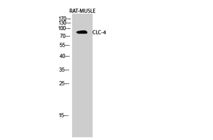 Western blot - CLC-4 Polyclonal Antibody from Signalway Antibody (40755) - Antibodies.com