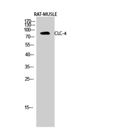 Western blot - CLC-4 Polyclonal Antibody from Signalway Antibody (40755) - Antibodies.com