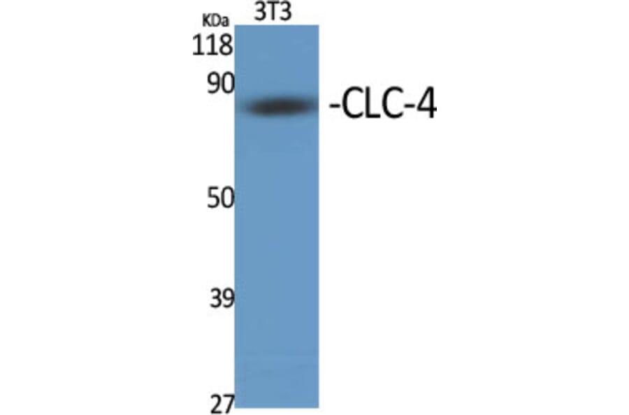 Western blot - CLC-4 Polyclonal Antibody from Signalway Antibody (40755) - Antibodies.com