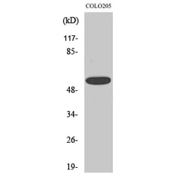 Western blot - CLCC1 Polyclonal Antibody from Signalway Antibody (40757) - Antibodies.com