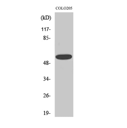 Western blot - CLCC1 Polyclonal Antibody from Signalway Antibody (40757) - Antibodies.com