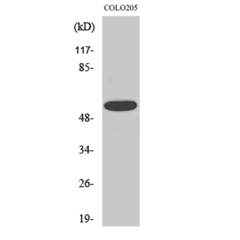 Western blot - CLCC1 Polyclonal Antibody from Signalway Antibody (40757) - Antibodies.com